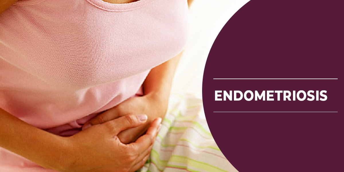 Endometriosis