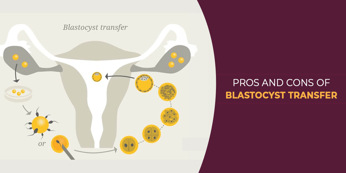 Blastocyst Transfer