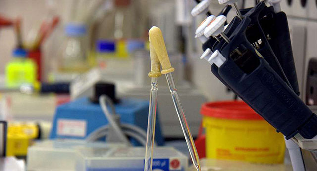 IUI Treatment in Noida and Delhi NCR